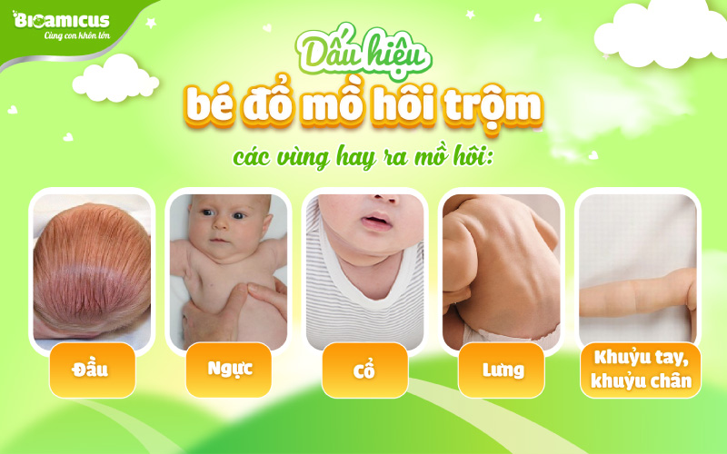 dấu hiệu bé đổ mồ hôi trộm