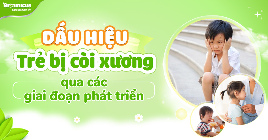 Dấu hiệu trẻ bị còi xương qua các giai đoạn - Mẹ cần lưu ý