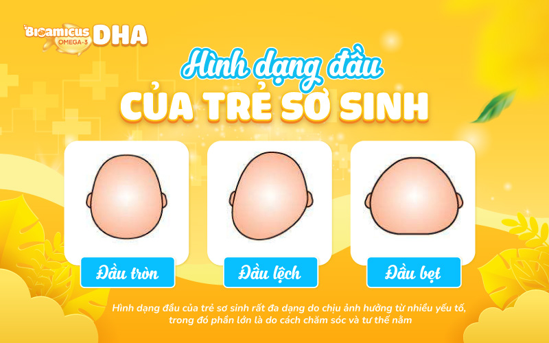 hình dạng đầu của trẻ sơ sinh