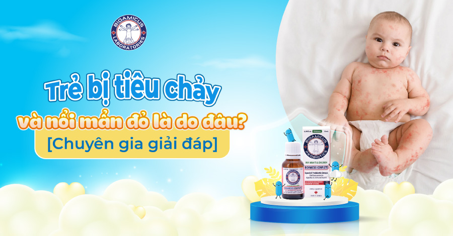 Trẻ bị tiêu chảy và nổi mẩn đỏ: nguyên nhân và giải pháp