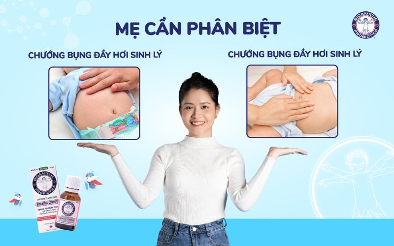 Phân biệt triệu chứng chướng bụng đầy hơi