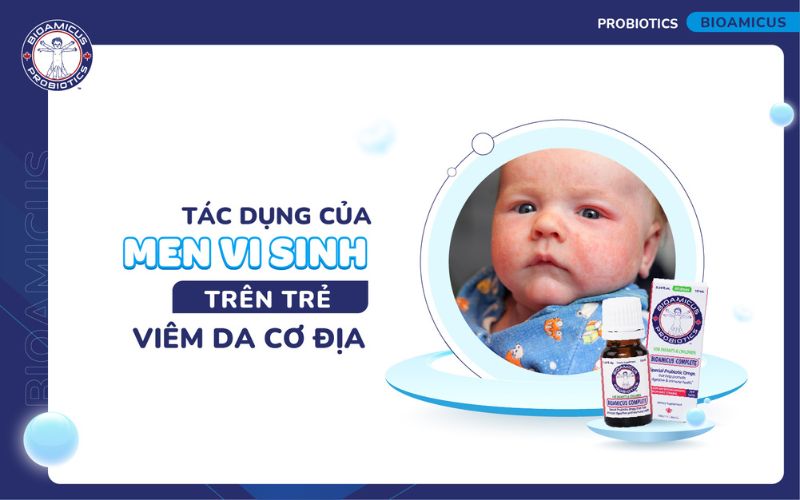 Tác dụng của men vi sinh trên trẻ viêm da cơ địa