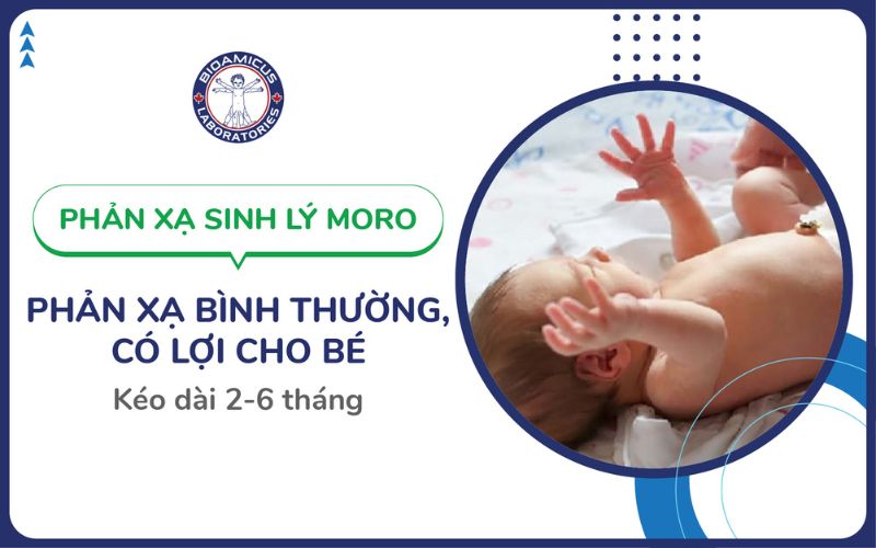trẻ sơ sinh hay giật mình hoảng hốt do phản xạ Moro