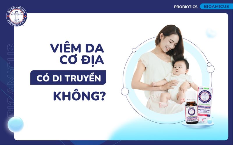 Viêm da cơ địa có di truyền không?