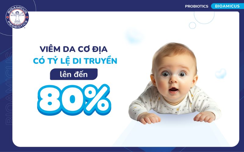 Viêm da cơ địa có tính chất di truyền