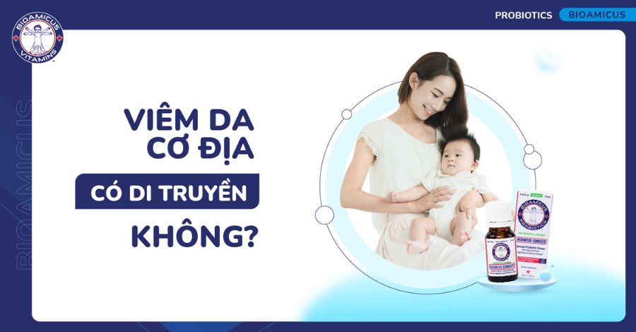 Viêm da cơ địa có di truyền không? GÓC GIẢI ĐÁP