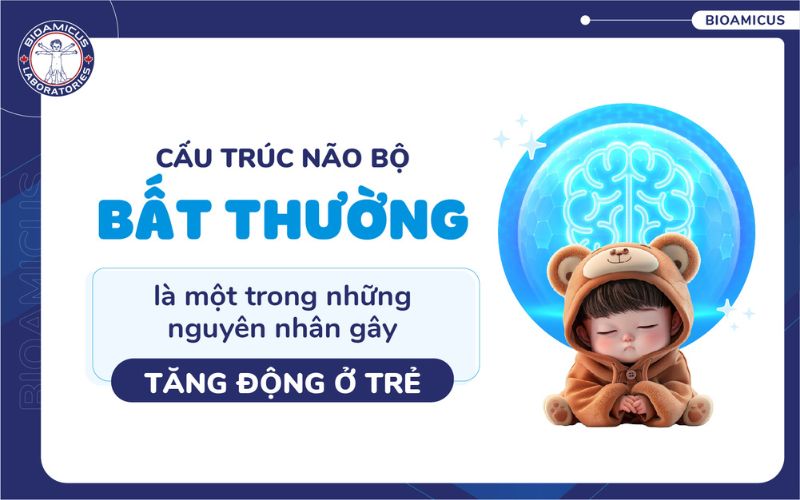 Cấu tr&uacute;c n&atilde;o bộ bất thường g&acirc;y tăng động ở trẻ