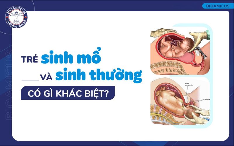 Trẻ sinh mổ v&agrave; sinh thường c&oacute; g&igrave; kh&aacute;c biệt?
