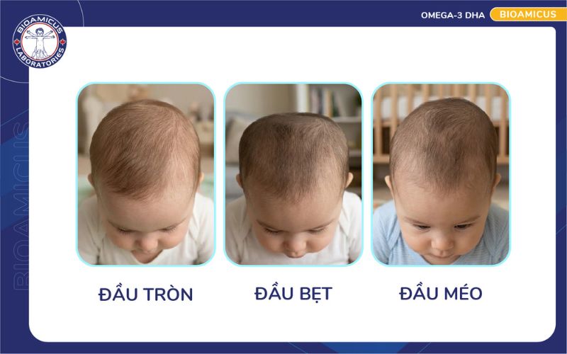 h&igrave;nh dạng đầu của trẻ sơ sinh