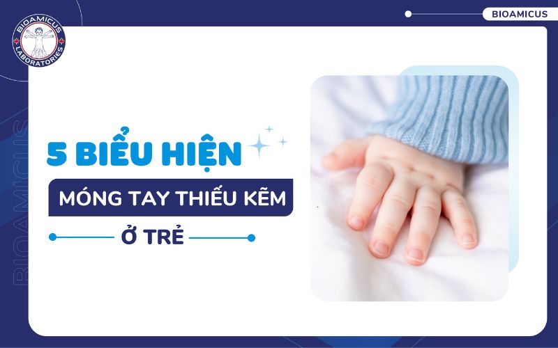 M&oacute;ng tay thiếu kẽm ở trẻ