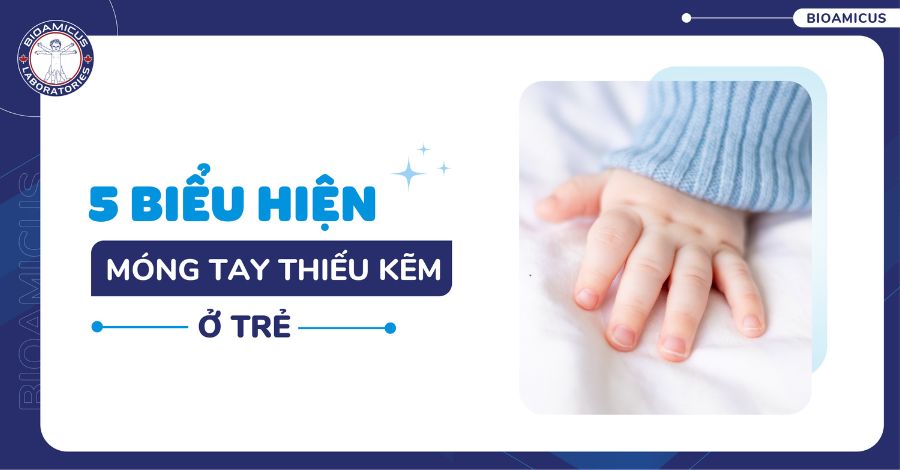5 Biểu hiện móng tay thiếu kẽm ở trẻ. Mẹ cần lưu ý