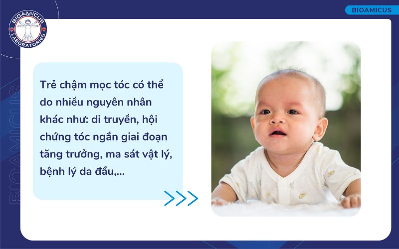 Nguy&ecirc;n nh&acirc;n kh&aacute;c g&acirc;y chậm mọc t&oacute;c