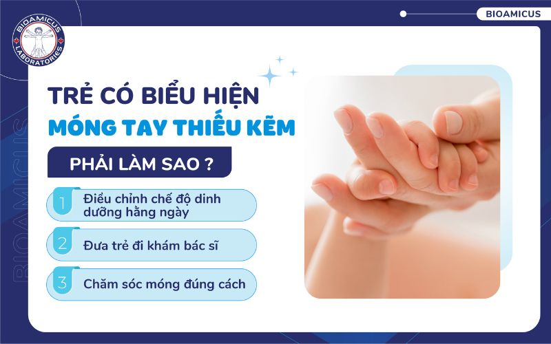 M&oacute;ng tay trẻ thiếu kẽm phải l&agrave;m sao?
