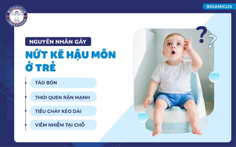 Nguy&ecirc;n nh&acirc;n g&acirc;y nứt kẽ hậu m&ocirc;n