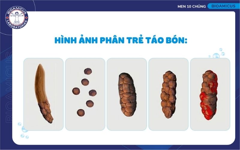 H&igrave;nh ảnh ph&acirc;n trẻ t&aacute;o b&oacute;n