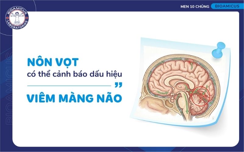 Viêm màng não có thể gây nôn vọt