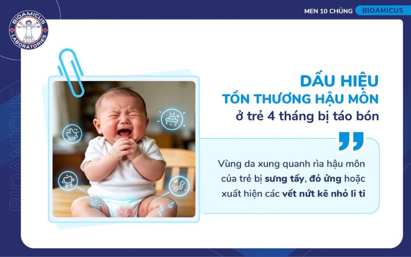 Nhận biết trẻ 4 th&aacute;ng bị t&aacute;o b&oacute;n qua dấu hiệu tổn thương v&ugrave;ng hậu m&ocirc;n
