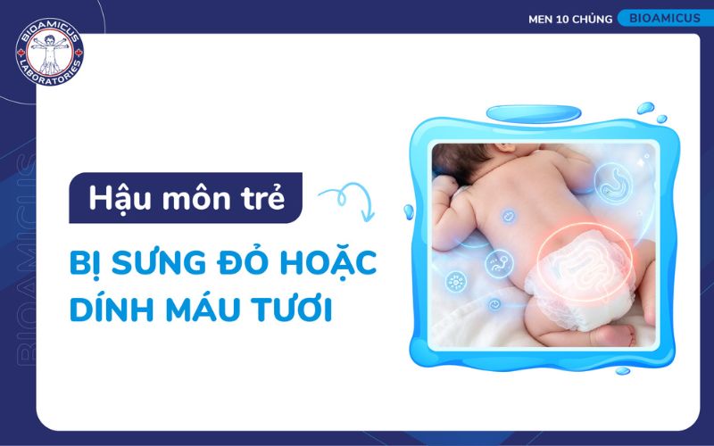 Nhận biết trẻ bị t&aacute;o b&oacute;n qua hậu m&ocirc;n bị sưng đỏ hoặc d&iacute;nh m&aacute;u tươi của b&eacute;