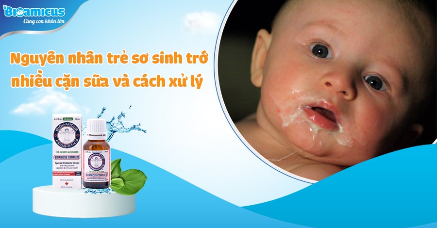 Tiết lộ nguyên nhân trẻ sơ sinh trớ nhiều cặn sữa và cách xử lý