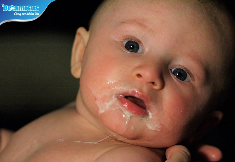 Trẻ sơ sinh trớ nhiều cặn sữa